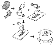 Kumtunza Mgongwa wa UKIMWI